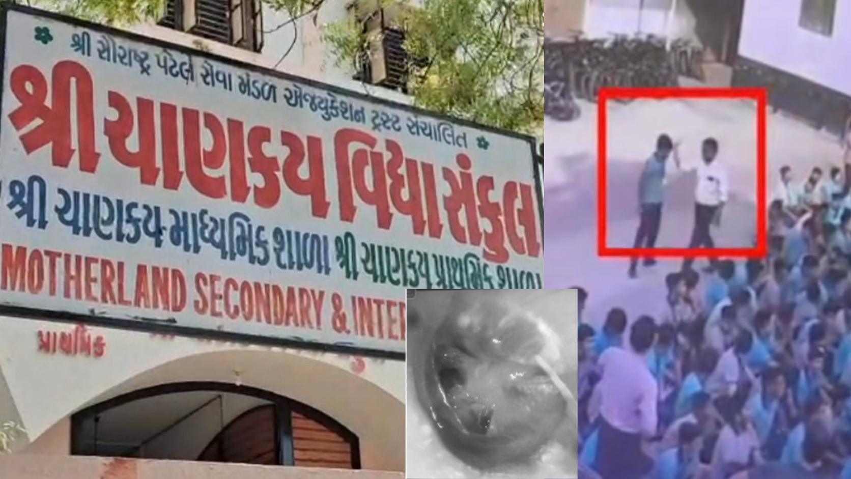 ahmedabad-nikol-chanakya-school-teacher-slapped-student-eardrum-ruptured
